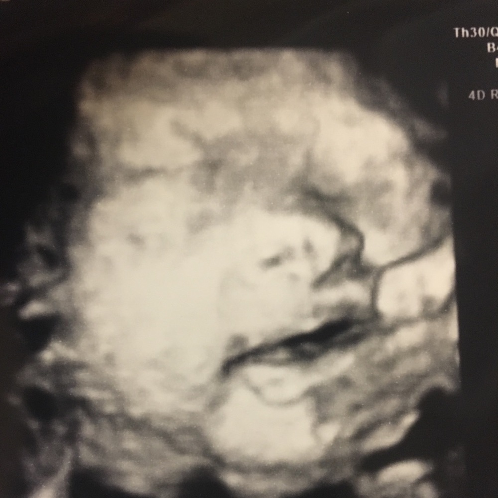 Meet your Posher, JP